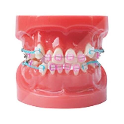 Ortho Ceramic Bracket Dental Orthodontic Model with Metal and Ceramic Brackets Dental Teeth Study Model ALL Ceramic