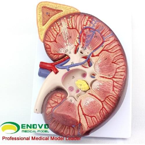 Adrenal gland kidney neoplasms progesterone kidney transplantation