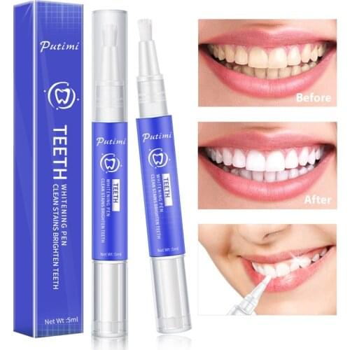OMY LADY Products For Teeth Whitening