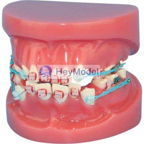 HeyModel Fixed Orthodontic model All ceramic bracket tooth model Dentistry teaching