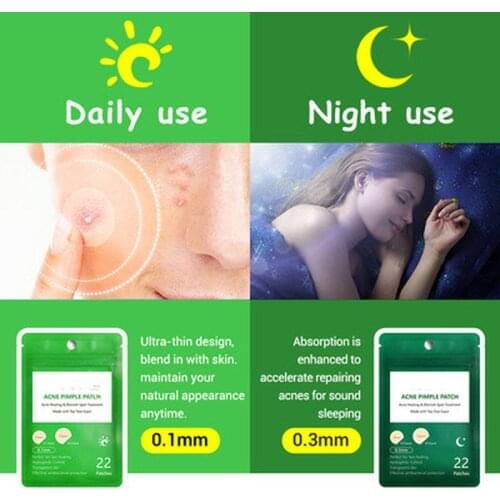 Vinkkatory Lip Gloss