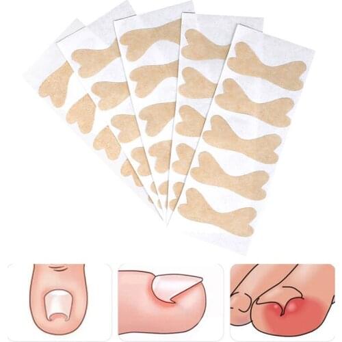 Ingrown Toenail Corrector Sticker Paronychia Treatment Recover Corrector Toe Inlay Nail Corrector Nail Patch Correction Sticker