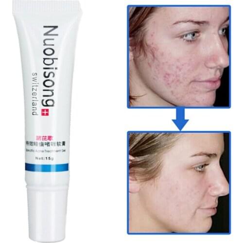 3pcs/lot Nuobisong Specific Acne Treatment Gel, Face care effectively remove pimples without irritating