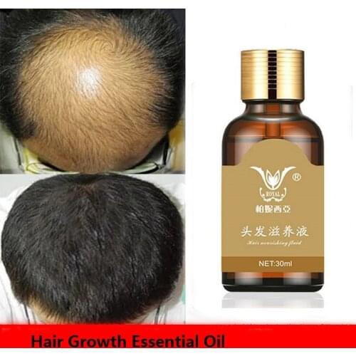 30ML Fast Hair Growth Essence Hair Loss Products Hair Growth Fibras Cabelo Shampoo Cremes De Tratamento Para Cabelos Hair Care