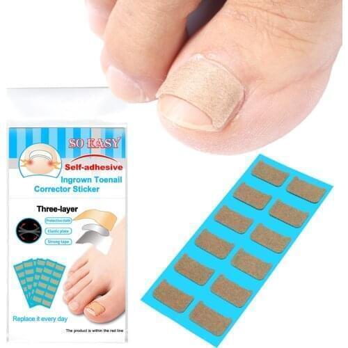 60Pcs Ingrown Toenail Correction Stickers Nail Corrector Patches Paronychia Treatment Recover Sticker Pedicure Foot Care Tools