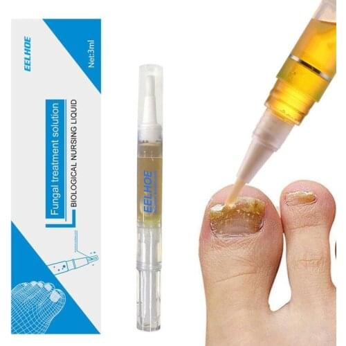 Fungal Nail Liquid Treatment Pen Onychomycosis Paronychia Anti Fungal Nail Infection Chinese Herbal Medicinal Nail Care