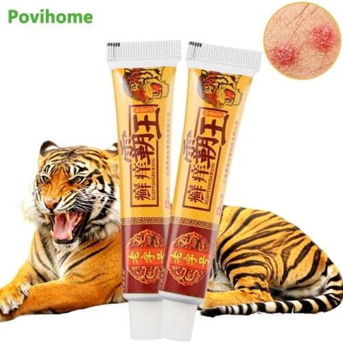 2pcs Skin Psoriasis Cream Antibacterial Dermatitis Eczematoid Eczema Ointment Psoriasis Skin Rash Urticaria Desquamation P1297