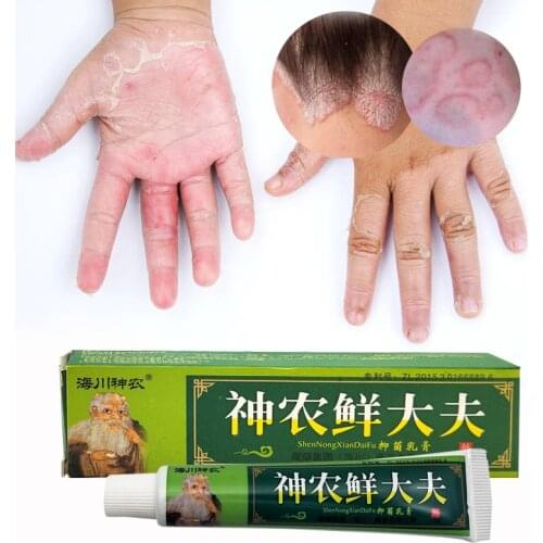 15g Natural Chinese Medicine Herbal Anti Bacteria Cream Psoriasis Eczema Ointment Treatment High Quality Herbal Cream
