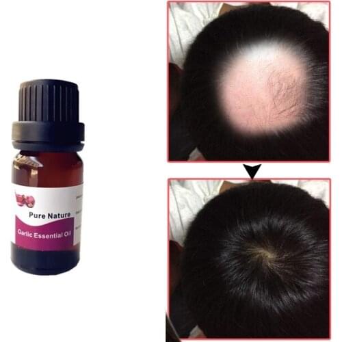 Nature Hair Care Garlic Essential Oil for Dry And Maintenance Hair Nutrition Essential Oil For Hair Straightening 10ml