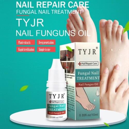 Kills Bacteria Nail Care Treatment Nail Fungus Oil Onychomycosis Paronychia Anti Fungal Nail Infection 10ml Repair Nails