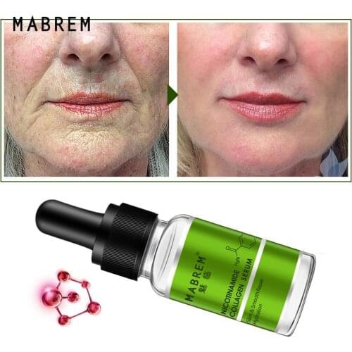 Nicotinamide Collagen Repair Solution Serum Repair Skin Anti-aging Hyaluronic Acid Whitening Skin Care Essence Face Care Water