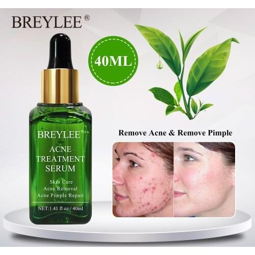 BREYLEE Acne Treatment Serum 40ml Face Facial Essence Anti Acne Scar Removal Cream Skin Care Whitening Pimple Remover For Acne