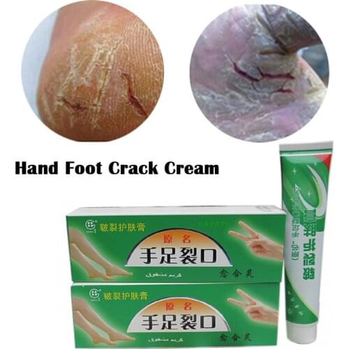 Hand Foot Crack Cream Heel Chapped Peeling Feet and Hands Repair Anti Dry Crack Skin Chinese Medicinal Ointment Skin Care