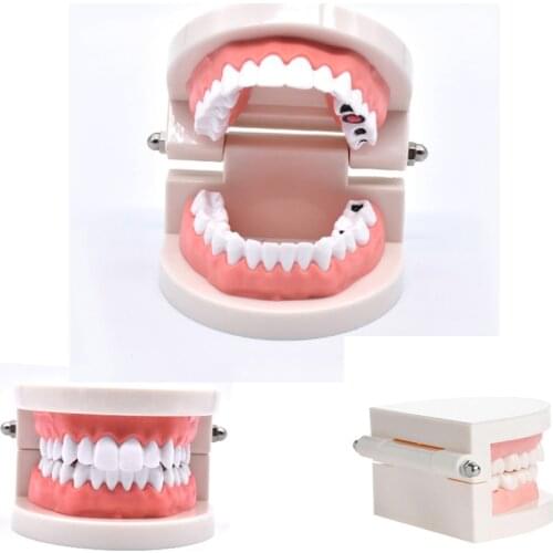 1 pcs Teeth Model Standard Tooth Teaching Dental Child Kid training Model Disease Teeth Medical Model Disease Teaching Study