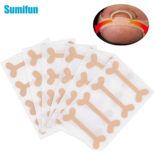 20pcs Toe Nail Straightener Ingrown Toenails Design Band Aid Relief Pain Paronychia Correction Patch Repair Bandage Foot Care
