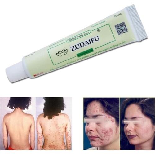 Cream for Psoriasis ointment for the treatment of Dermatitis, eczematoid ointment for Psoriasis in skin Repair, 15g