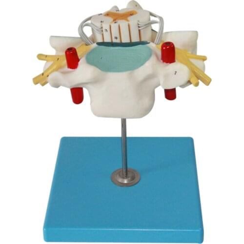 Cervical vertebrae spine vertebrae model Cervical spinal cord and spinal nerve amplification model