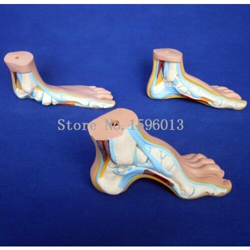 Normal, Flat and Arched Foot Model,human foot model 3pcs/set
