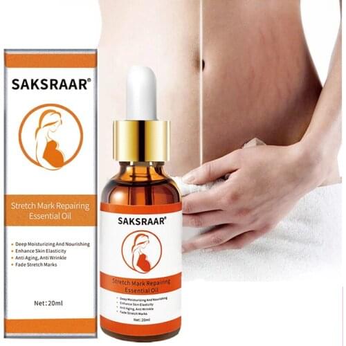 Stretch Mark Remover Essential Oil Skin Care Cream Is Used To Remove Stretch Marks Pregnant Women Relax Pregnancy Oil Maternity