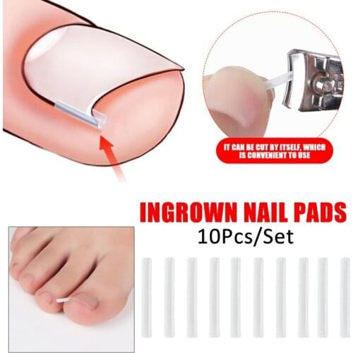 10pcs/set Ingrown Nail Pad Groove Ortho Foot Care Tool Toenail Corrector Pedicure