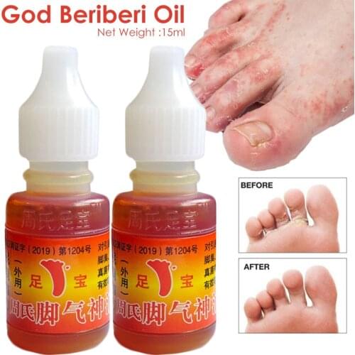 1PC Foot Beriberi Oil Athletes Foot Plaster Erosive Beriberi Remove Sweat Odor Psoriasis Peeling Antibacterial Ointment Care