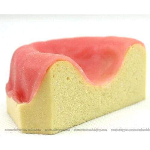 CMAM/12616 Dental- Toothless jaw, implant, Human Oral Dental Medical Teaching Anatomical Model