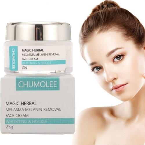 Chumolee Azelaic Acid 10% Whitening Cream Freckle Remove Melasma Acne Dark Pigment Spots Melanin Alpha Arbutin Face Cream