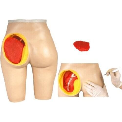 Advanced Hip Muscle Injection And Anatomical Structure Model BIX-H4T WBW095