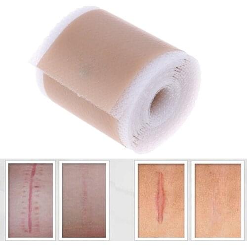 Efficient Surgery Scar Removal Silicone Gel Sheet Therapy Patch For Acne Trauma Burn Scar Skin Repair Scar Treatment 4x150cm