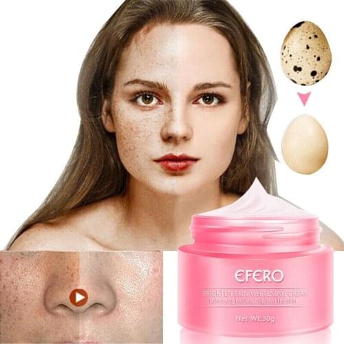 Newly Skin Whitening Cream Freckle Cream Remove Melasma Acne Dark Pigment Spots Melanin Pimple Face Care 19ing