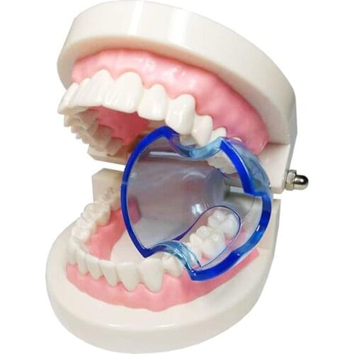 Mouth Opener Dental Orthodontic Braces Lip Cheek Retractor Expander Dental Mouth Oral Tooth Tool Care Orthodontic Accessory
