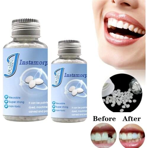 Solid Denture Adhesive Glue Oral Cavity Temporary Tooth Filling Solid Material Replace Missing Repair DIY Kit