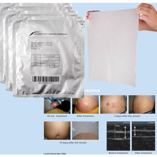New Arrival 10pcs Antifreeze Membrane 27*30cm 34*42cm Antifreezing Anti-freezing Pad For Cryo Therapy Free Shipping