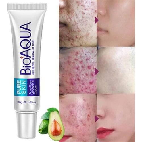 30g Acne Scar Remover Cream Anti-Acne Treatment Face Cream Moisturizing Whitening Oil Control Shrink Pores Anti-Aging Smoothing