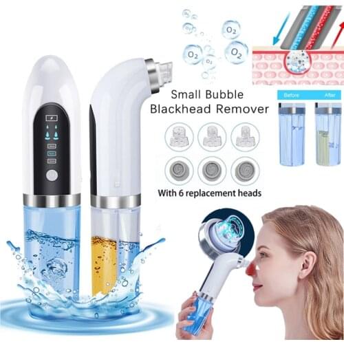 YANQINA Vacuum Pore Cleaners