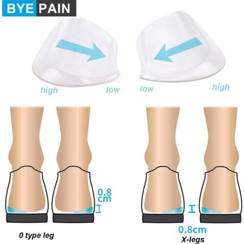 1Pair Gel Orthopedic Insoles Shoe Inserts Medial & Lateral Heel Wedge Lift Silicone Pads Corrective O/X Type Leg for Women Men