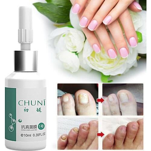 New 2021 20ml Accelerate Growth Treatment Ringworm Peeling Leuconychia Harden Portable Nail Repair Glue Ointment Relustering
