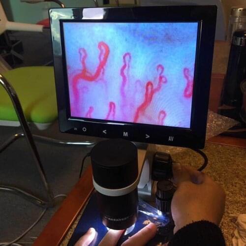 2021 New Manufacturer Price Advanced Blood Capillary Microcirculation Microscope Test Machine Hematology Analyzer