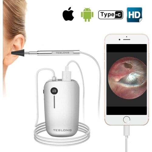 Ear Cleaning Type-c Endoscope USB Ear Spoon 5.5mm 1.3MP Mini Camera Vudeotape Android PC Ear pick Otoscope Borescope IP67 720HD