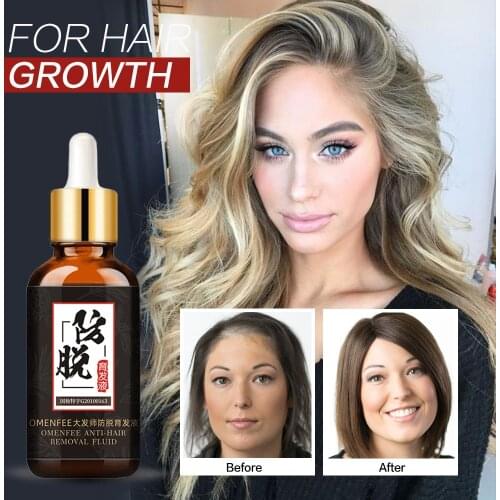 Hair Care Hair Growth Essential Oils Essence Grow Hair Liquid Fluid Prevent Hair Loss Health Care Beauty Dense Hair Growth Serum