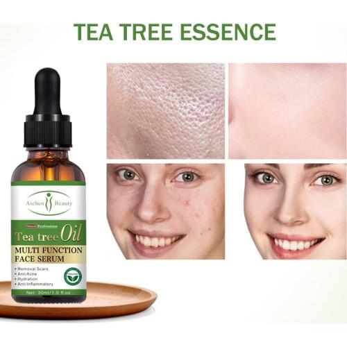 30g Ordinary Serum Natural Pure natural plant extracts Serum Facial Moisturizing Anti-Acne Serum Repairing Skin Face Neck
