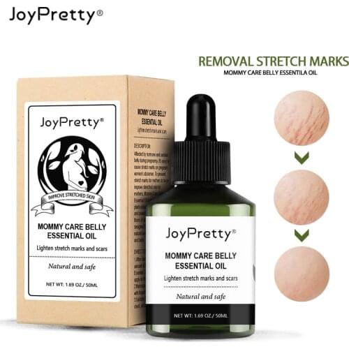 AUQUEST Stretch Marks Removal Essential Oil Skin Care Treatment For Pregnant Women Stretch Maternity Buttock Breast Body Care