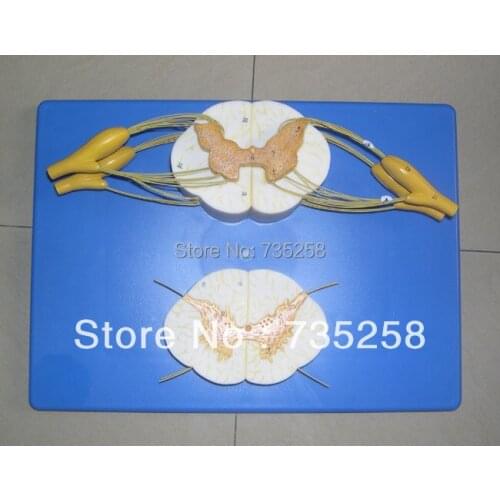 The Spinal Cord and Spinal Nerve Branches Enlargement Model