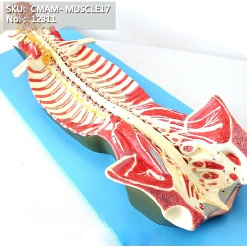 CMAM/12311 Spinal Cord in the Spinal Canal, 1.5x , Plastic Human Body Muscle Teaching Anatomical Model