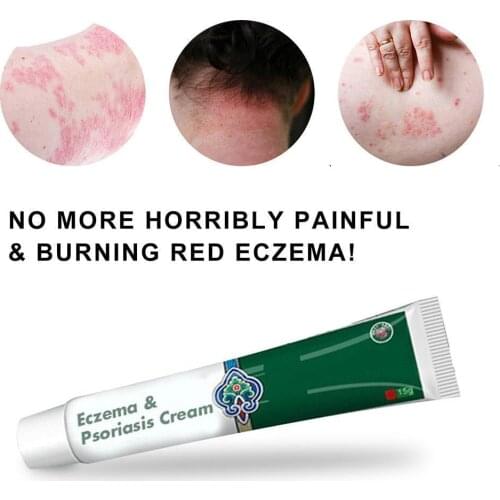 Xiyu Fushiqing Xiyu Bawang Fushiqing Herbal Cream Xinjiang Antipruritic Antibacterial Cream X0A3