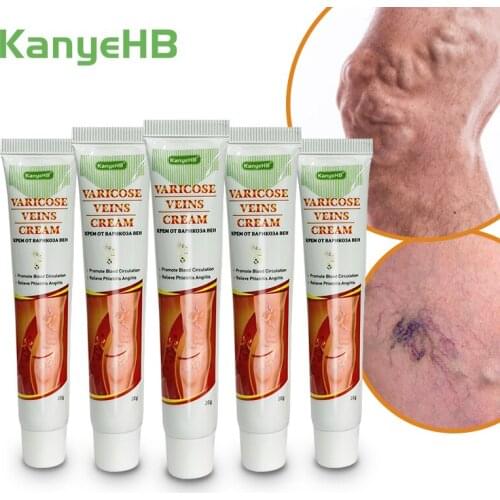 5pcs Varicosity Medical Ointment Varicose Veins Herbal Plaster Vasculitis Phlebitis Treatment Cream Herbal Extract ComponentA643