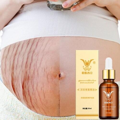 Stretch Marks Removal Essential Oils Pure Natural Stretch Marks Remover Obesity Postpartum Anti-wrinkle Repair Cream Skin Care