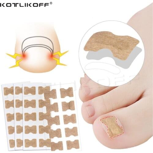 Ingrown Toenail Corrector Stickers Paronychia Treatment Pedicure Toe Nail Care Corrector Patch Correction Stickers 10-50Pcs