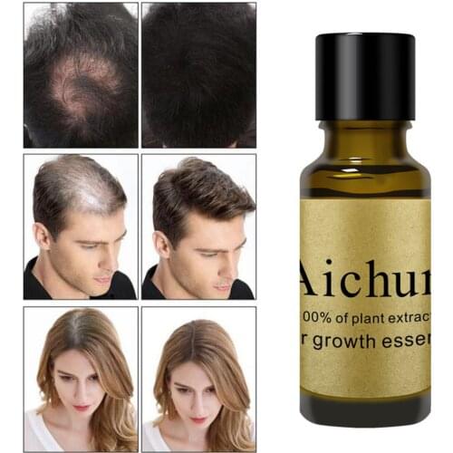 Ginger Nourishing Hair Treament Liquid Fast Hair Growth Product Essential Oil Anti Preventing Hair Lose Damaged Serum Keratin