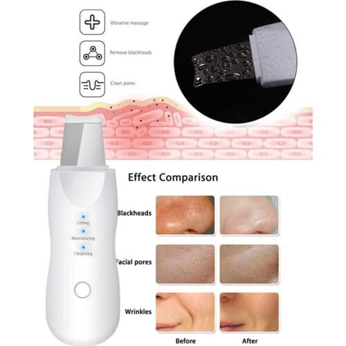 Rechargeable Ultrasonic Face Skin Scrubber Facial Cleaner Peeling Vibration Blackhead Removal Exfoliating Pore Cleaner Tools